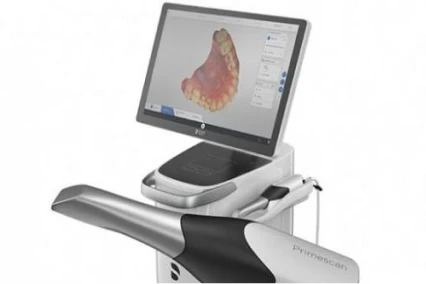 Digital dental impression scanner used for precise tooth mapping.