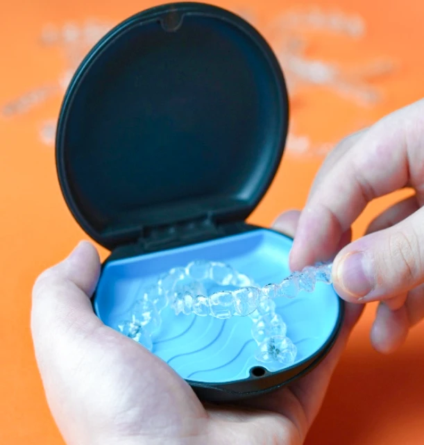 Clear aligners stored in a protective case, used for invisible orthodontic treatment in San Diego.