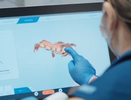 Dentist examinating 3d scan before a procedure.